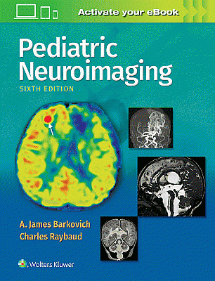 Pediatric Neuroimaging. Edition Sixth
