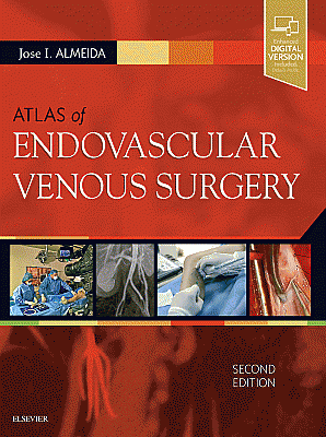 Atlas of Endovascular Venous Surgery. Edition: 2