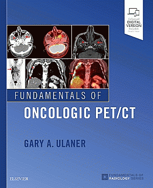Fundamentals of Oncologic PET/CT