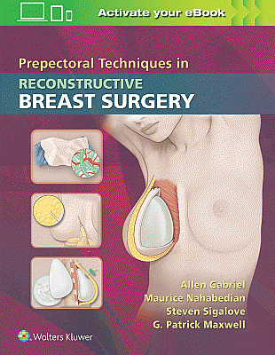 Prepectoral Techniques in Reconstructive Breast Surgery. Edition First