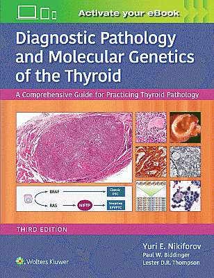 Diagnostic Pathology and Molecular Genetics of the Thyroid. Edition Third
