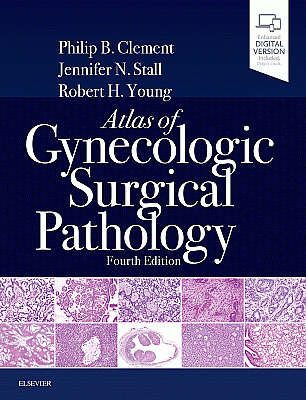 Atlas of Gynecologic Surgical Pathology. Edition: 4
