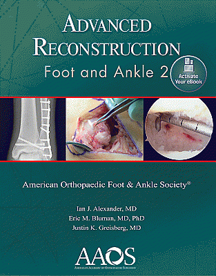 Advanced Reconstruction: Foot and Ankle 2: Print + Ebook. Edition Second