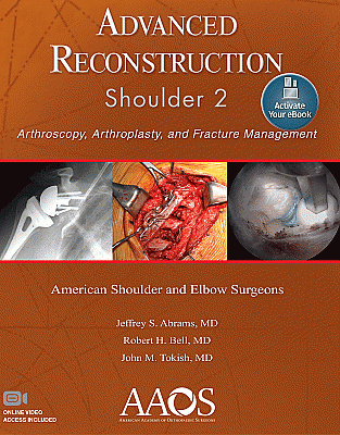 Advanced Reconstruction: Shoulder 2: Print + Ebook with Multimedia. Edition Second