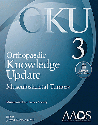 Orthopaedic Knowledge Update: Musculoskeletal Tumors 3: Print + Ebook. Edition Third