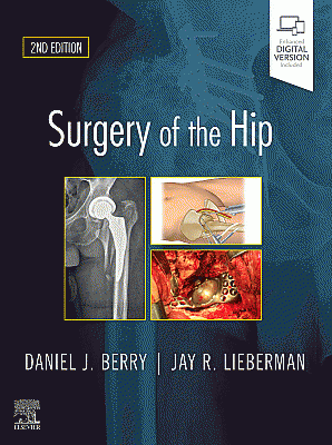Surgery of the Hip. Edition: 2