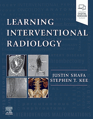 Learning Interventional Radiology