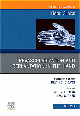 Revascularization and Replantation in the Hand, An Issue of Hand Clinics
