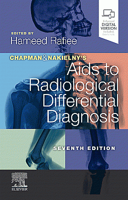 Chapman & Nakielny's Aids to Radiological Differential Diagnosis. Edition: 7
