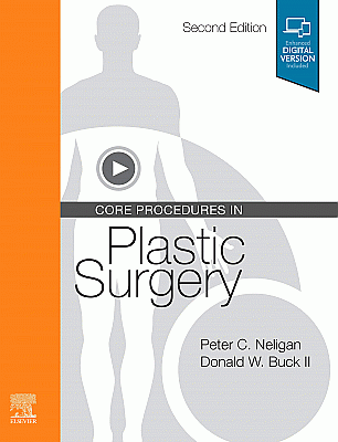 Core Procedures in Plastic Surgery. Edition: 2