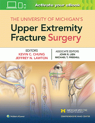 The University of Michigan's Upper Extremity Fracture Surgery. Edition First