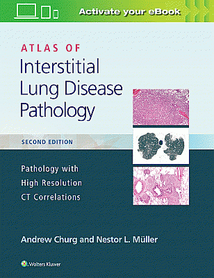 Atlas of Interstitial Lung Disease Pathology. Edition Second