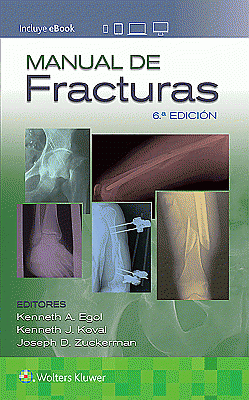 Manual de fracturas. Edition Sixth