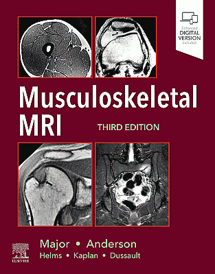 Musculoskeletal MRI. Edition: 3