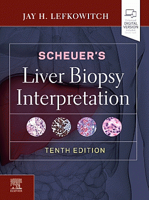 Scheuer's Liver Biopsy Interpretation. Edition: 10