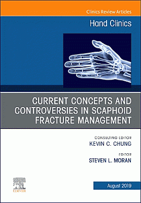 Current Concepts and Controversies in Scaphoid Fracture Management, An Issue of Hand Clinics