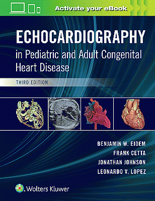 Echocardiography in Pediatric and Adult Congenital Heart Disease. Edition Third