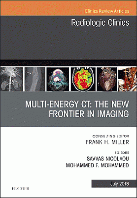 Multi-Energy CT: The New Frontier in Imaging, An Issue of Radiologic Clinics of North America