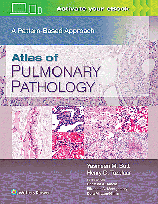 Atlas of Pulmonary Pathology. Edition First