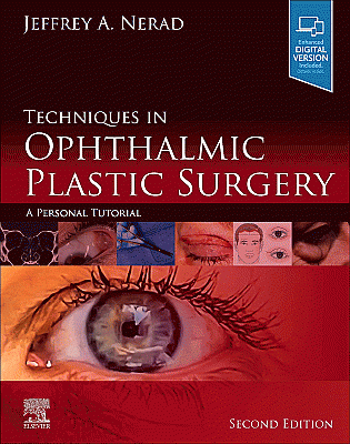 Techniques in Ophthalmic Plastic Surgery. Edition: 2