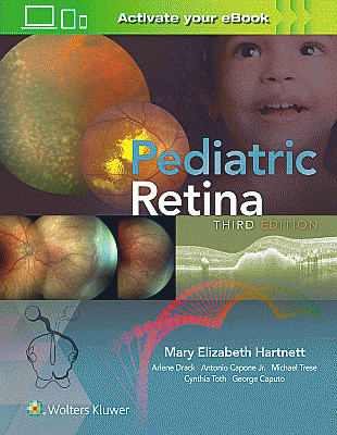 Pediatric Retina. Edition Third