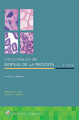 Interpretación de biopsias de la próstata. Edition Sixth