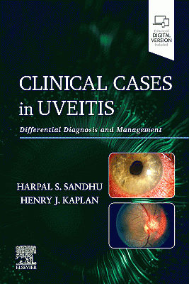 Clinical Cases in Uveitis