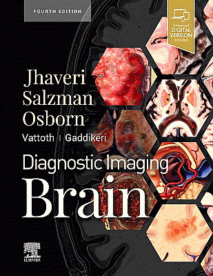 Diagnostic Imaging: Brain. Edition: 4