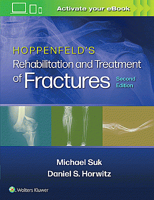 Hoppenfeld's Treatment and Rehabilitation of Fractures. Edition Second