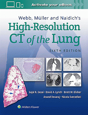 Webb, Müller and Naidich's High-Resolution CT of the Lung. Edition Sixth