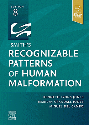 Smith's Recognizable Patterns of Human Malformation. Edition: 8