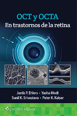 OCT y OCTA en trastornos de la retina. Edition First