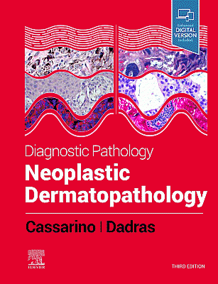 Diagnostic Pathology: Neoplastic Dermatopathology. Edition: 3