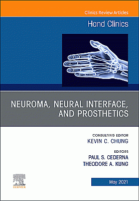 Neuroma, Neural interface, and Prosthetics, An Issue of Hand Clinics