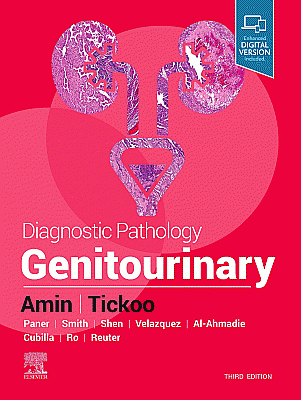 Diagnostic Pathology: Genitourinary. Edition: 3