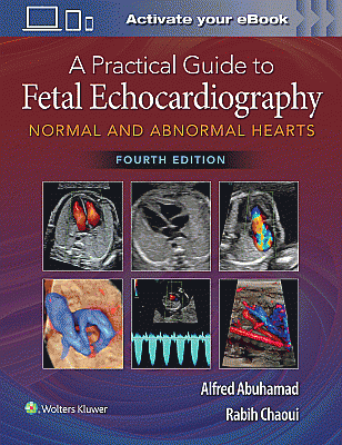 A Practical Guide to Fetal Echocardiography. Edition Fourth