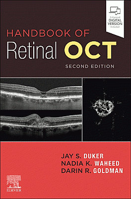 Handbook of Retinal OCT: Optical Coherence Tomography. Edition: 2