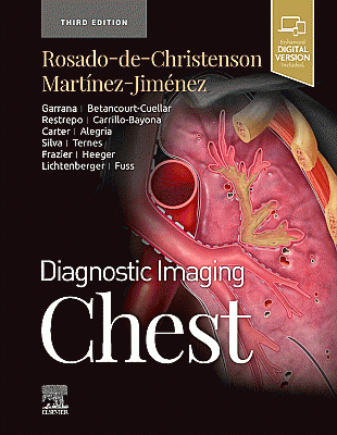 Diagnostic Imaging: Chest. Edition: 3