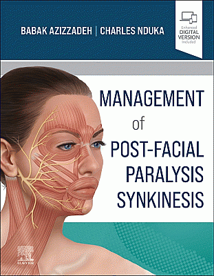 Management of Post-Facial Paralysis Synkinesis