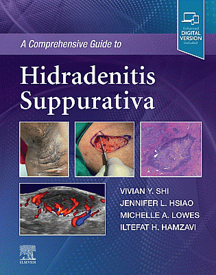 A Comprehensive Guide to Hidradenitis Suppurativa