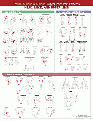Travell, Simons & Simons’ Trigger Point Pain Patterns Wall Chart. Edition Second