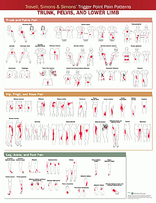 Travell, Simons & Simons’ Trigger Point Pain Patterns Wall Chart. Edition Second