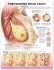 Understanding Breast Cancer 3E Paper