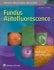 Fundus Autofluorescence. Edition Second