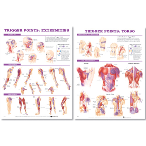 Trigger Point Chart Set 2nd Edition: Torso and Extremities - Laminated ISBN 9780781773072
