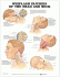 Whiplash Injuries of the Head and Neck Anatomical Chart