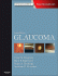 Glaucoma. Edition: 2