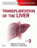 Transplantation of the Liver. Edition: 3