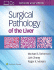 Surgical Pathology of the Liver. Edition First
