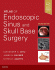 Atlas of Endoscopic Sinus and Skull Base Surgery. Edition: 2